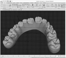 Dental Arch Measurement Image