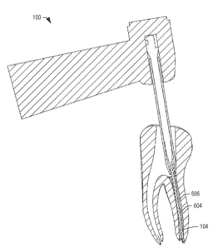 Root Canal Image
