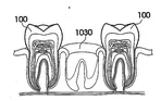 customized dental Image