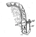Dental Instrument Image