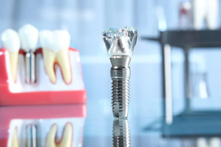 The Guide: Patenting Dental Implants