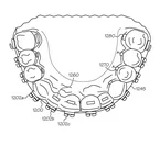 Successfully Patented Image