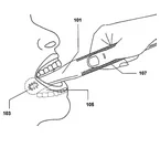 Intraoral Cameras Image