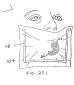 Successfully Patented Image